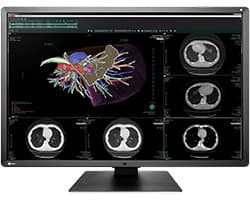 RadiForce RX660